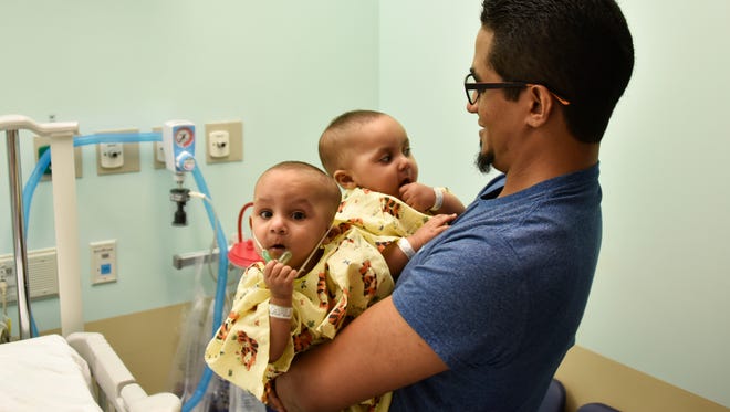 In this 2016 photoMarino Abel Camacho holds his conjoined daughters, Ballenie and Bellanie Camacho, before surgery at Maria Fareri Children's Hospital in Valhalla, N.Y.